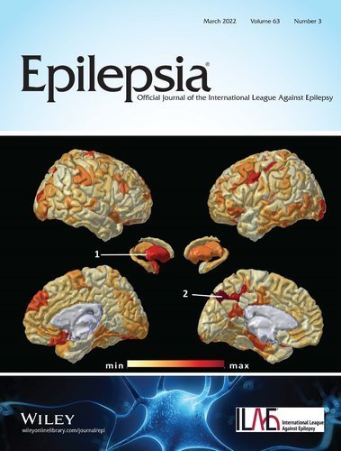 Epilepsia journal cover featuring FIND Neuro's brain heat map visualization