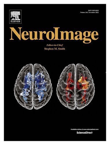 NeuroImage journal cover featuring FIND Neuro's dual-brain overlay visualization