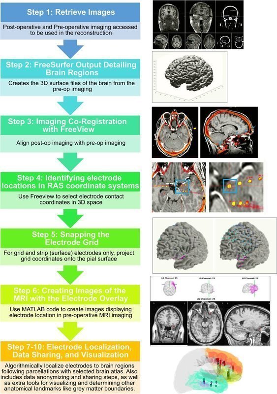 Modular pipeline for electrode reconstruction showing 7 processing steps
